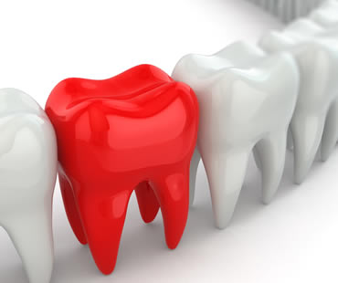 What’s a Dental Emergency?