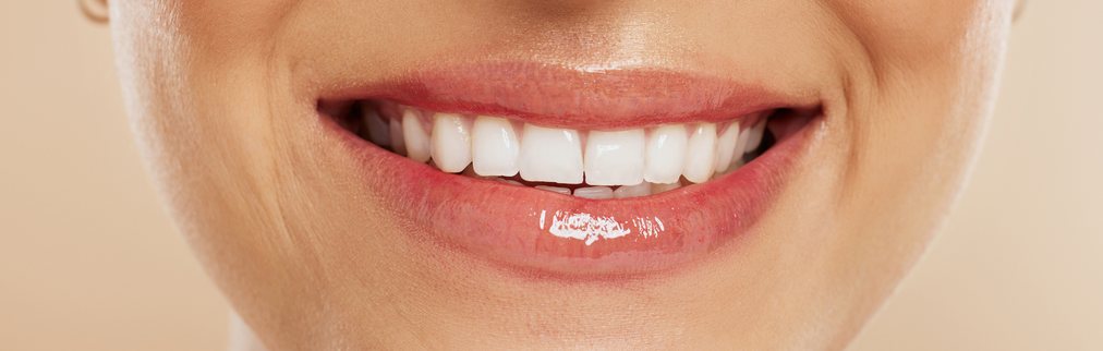 Close-up of a woman smiling with bright white teeth