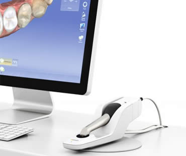 Saving Time with CEREC